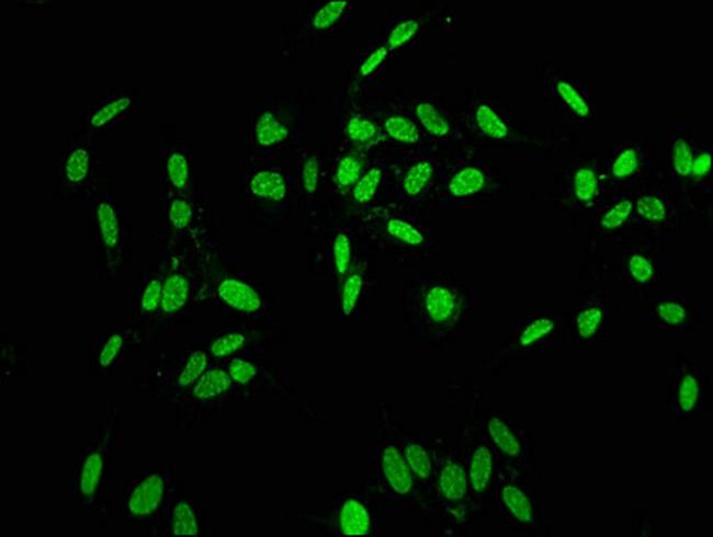 Phospho-Histone H1.2 (Thr164) Antibody in Immunocytochemistry (ICC/IF)