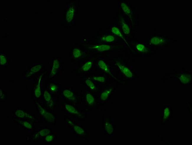 Formyl-Histone H1.2 (Lys159) Antibody in Immunocytochemistry (ICC/IF)