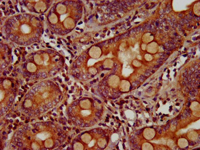 ZIC5 Antibody in Immunohistochemistry (Paraffin) (IHC (P))