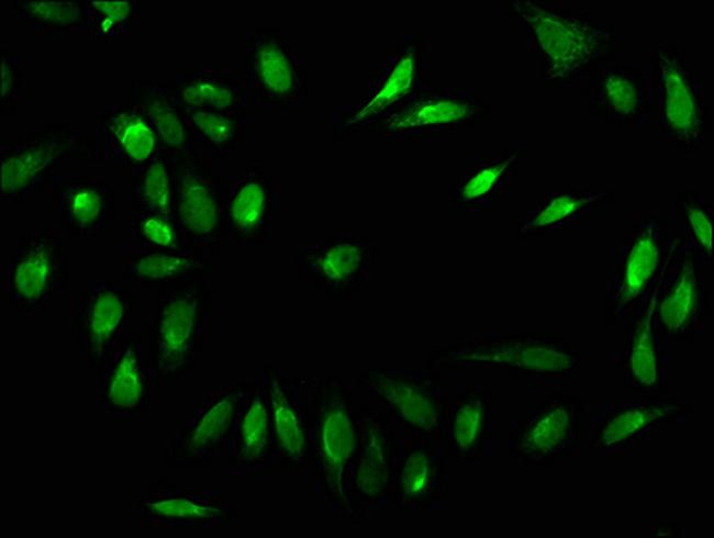 Formyl-Histone H1.2 (Lys84) Antibody in Immunocytochemistry (ICC/IF)