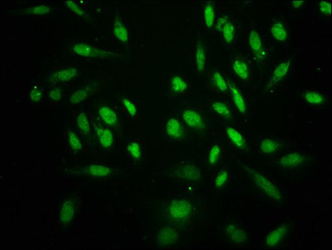 H3K18cr Antibody in Immunocytochemistry (ICC/IF)