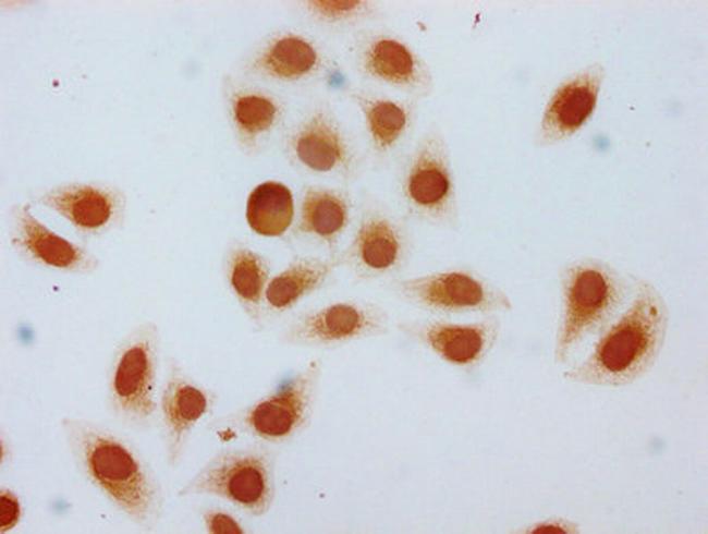 2-hydroxyisobutyryl-Histone H1.2 (Lys22) Antibody in Immunocytochemistry (ICC/IF)