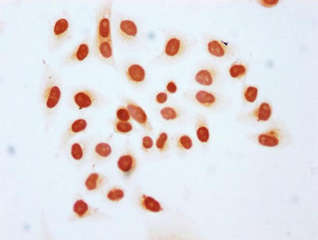 2-hydroxyisobutyryl-Histone H1.2 (Lys25) Antibody in Immunocytochemistry (ICC/IF)