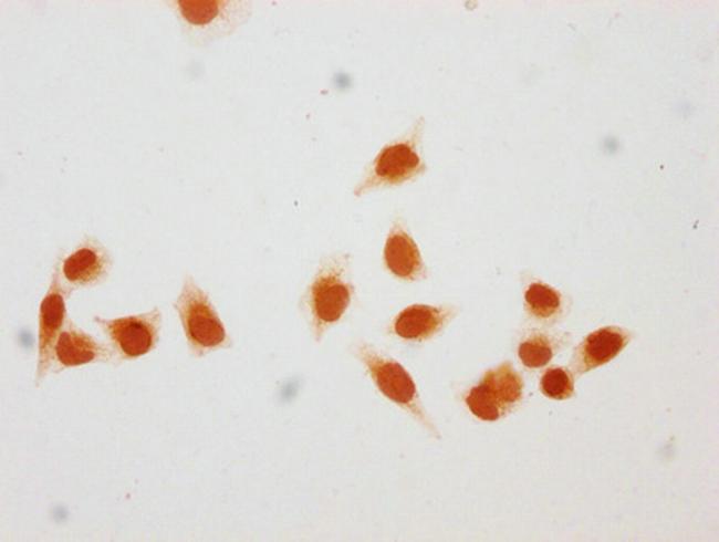 2-hydroxyisobutyryl-Histone H1.2 (Lys116) Antibody in Immunocytochemistry (ICC/IF)