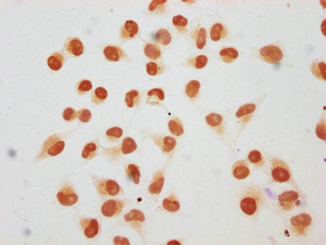 2-hydroxyisobutyryl-Histone H1.2 (Lys210) Antibody in Immunocytochemistry (ICC/IF)