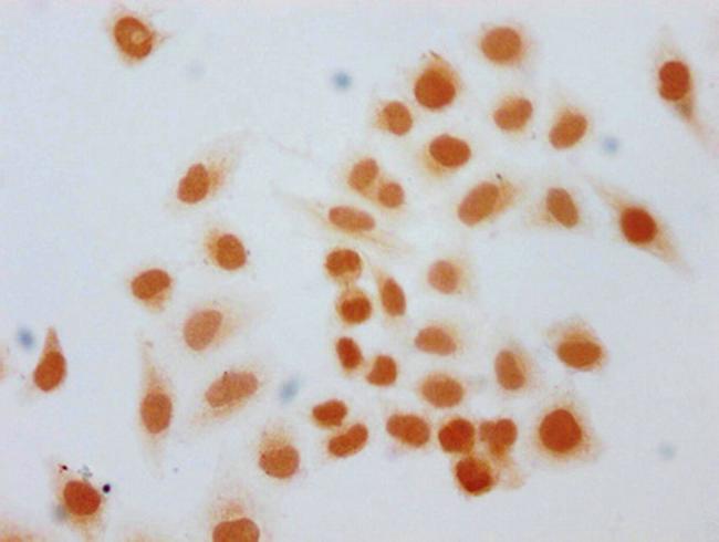 2-hydroxyisobutyryl-Histone H1.2 (Lys168) Antibody in Immunocytochemistry (ICC/IF)