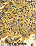 CDK2 Antibody in Immunohistochemistry (Paraffin) (IHC (P))