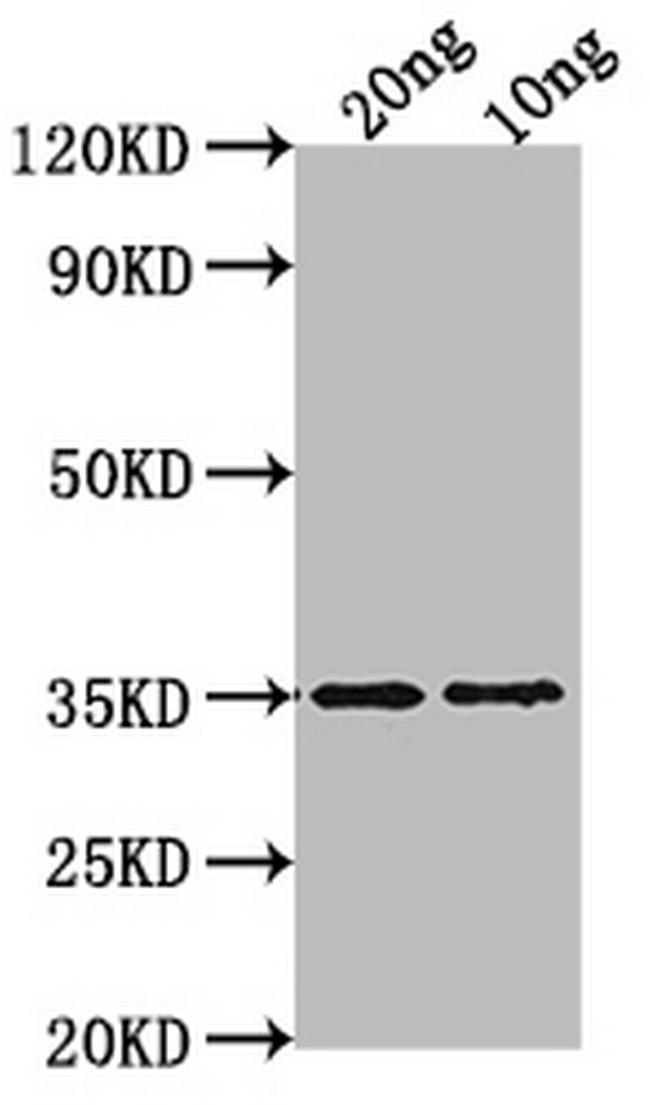 WRKY47 Antibody in Western Blot (WB)