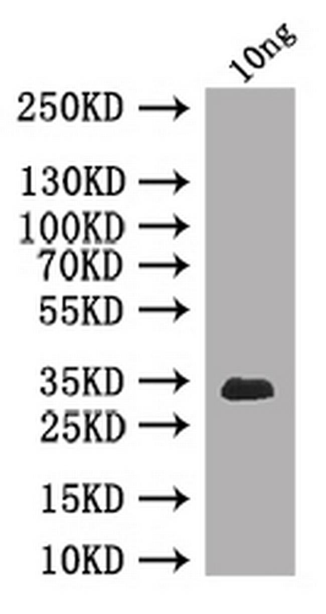 Clathrin Heavy Chain Antibody in Western Blot (WB)