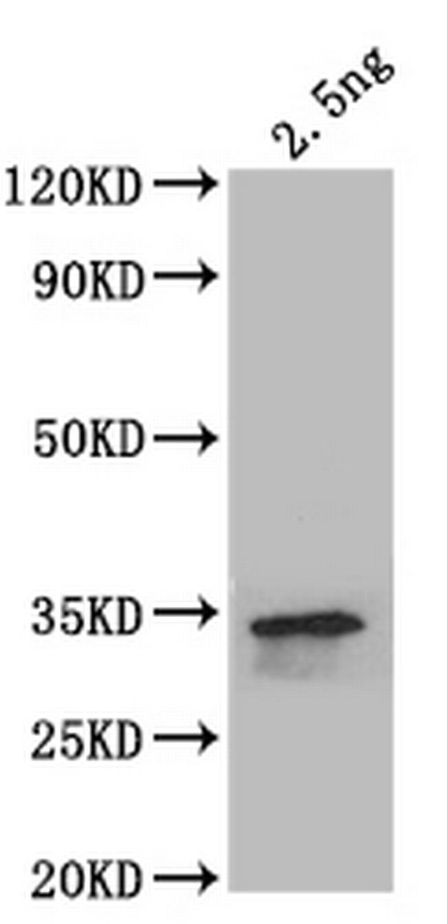 SPTB Antibody in Western Blot (WB)