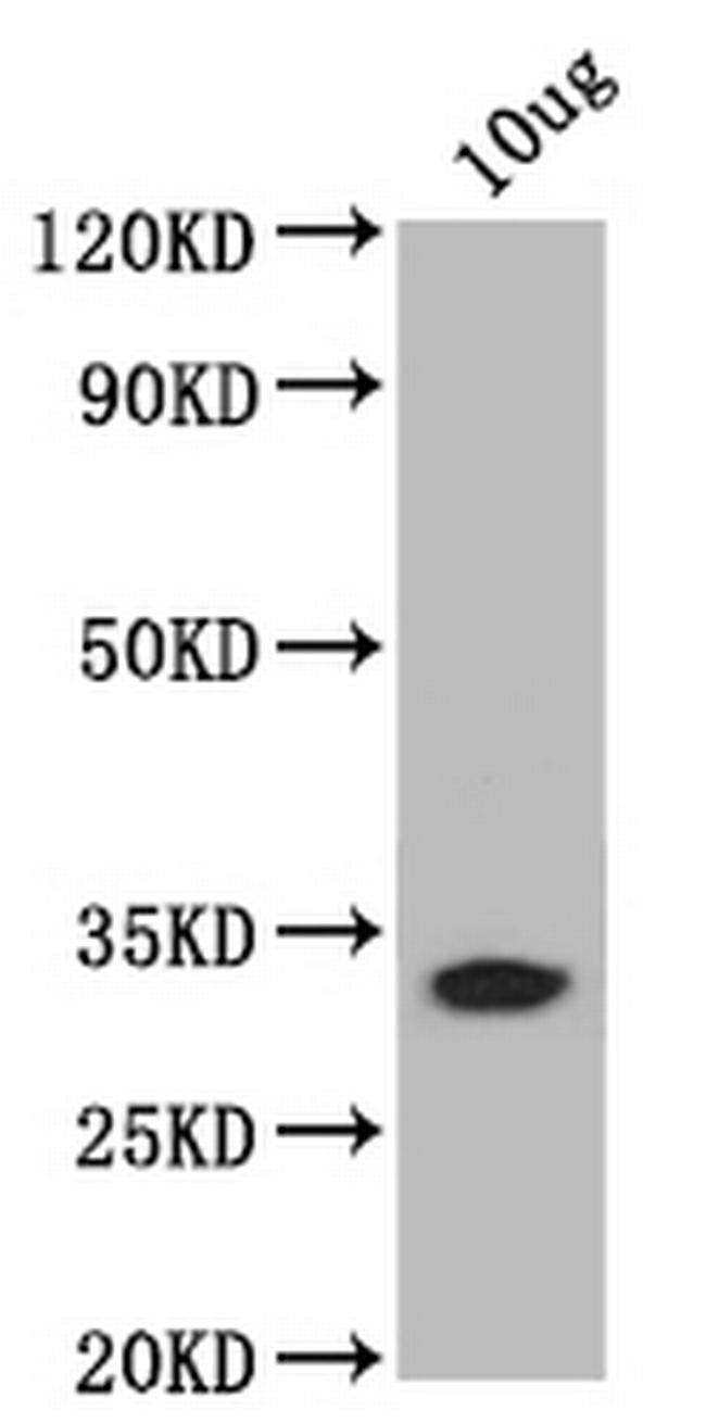 bamB Antibody in Western Blot (WB)