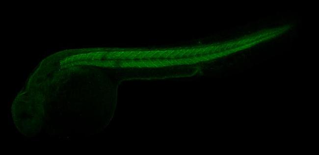 beta Actin Antibody in Immunohistochemistry (IHC)