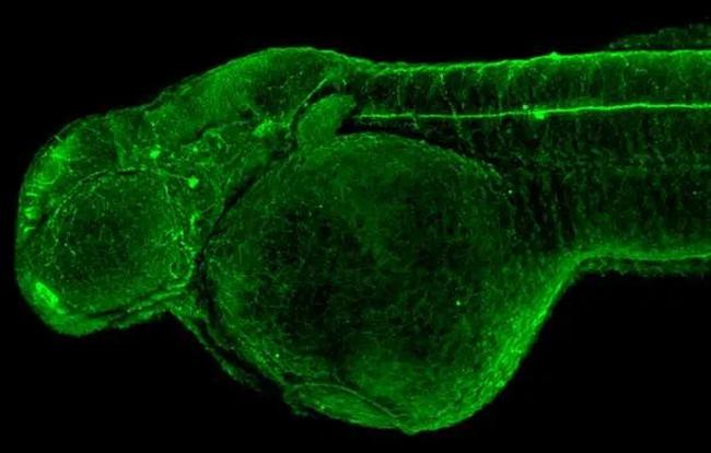 alpha Tubulin Antibody in Immunohistochemistry (IHC)