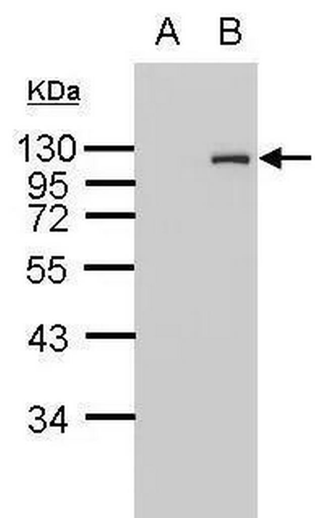 HA Tag Antibody in Western Blot (WB)