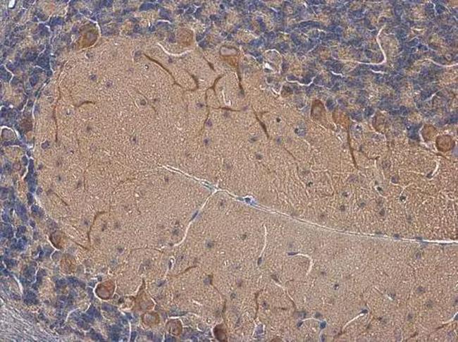 SSTR1 Antibody in Immunohistochemistry (Paraffin) (IHC (P))