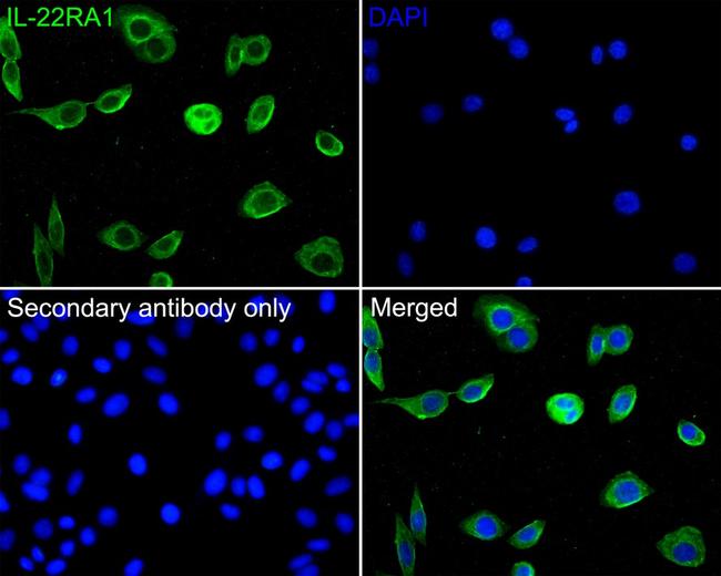 IL-22 Receptor alpha Antibody in Immunocytochemistry (ICC/IF)