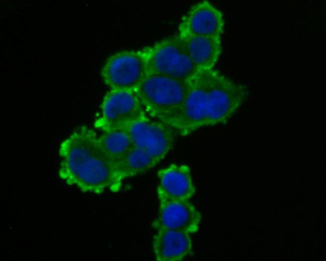 TRPV6 Antibody in Immunocytochemistry (ICC/IF)