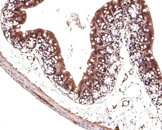 TMED5 Antibody in Immunohistochemistry (Paraffin) (IHC (P))