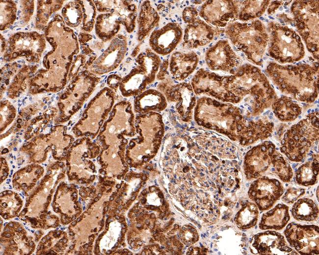 TIMM23 Antibody in Immunohistochemistry (Paraffin) (IHC (P))