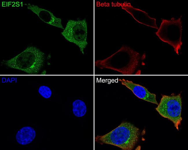 EIF2S1 Antibody in Immunocytochemistry (ICC/IF)