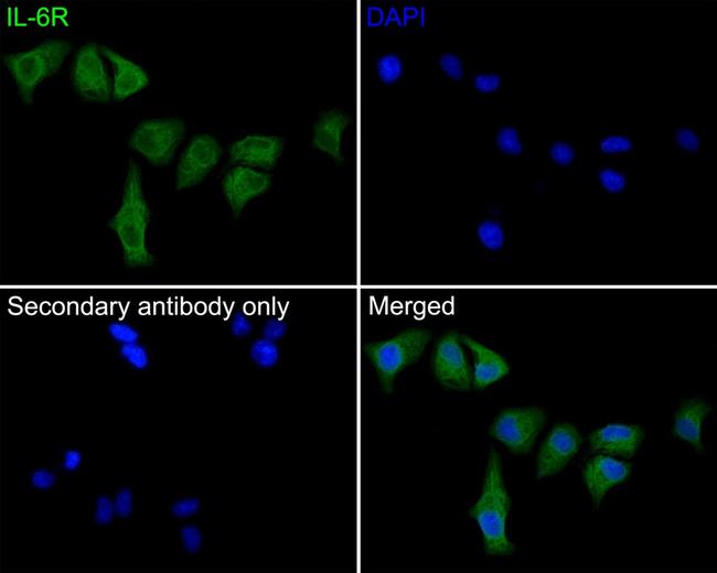 IL-6 Receptor Antibody in Immunocytochemistry (ICC/IF)