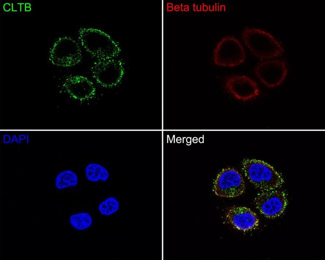 CLBT Antibody in Immunocytochemistry (ICC/IF)