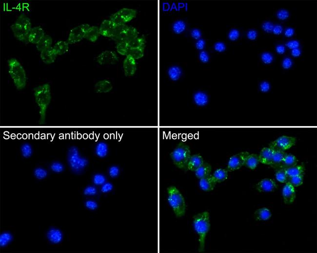 IL4R Antibody in Immunocytochemistry (ICC/IF)