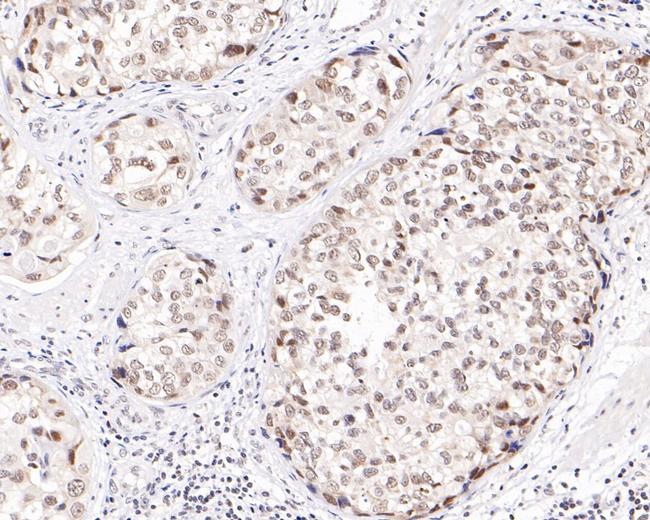 TBP Antibody in Immunohistochemistry (Paraffin) (IHC (P))