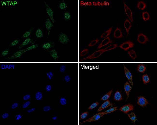 WTAP Antibody in Immunocytochemistry (ICC/IF)