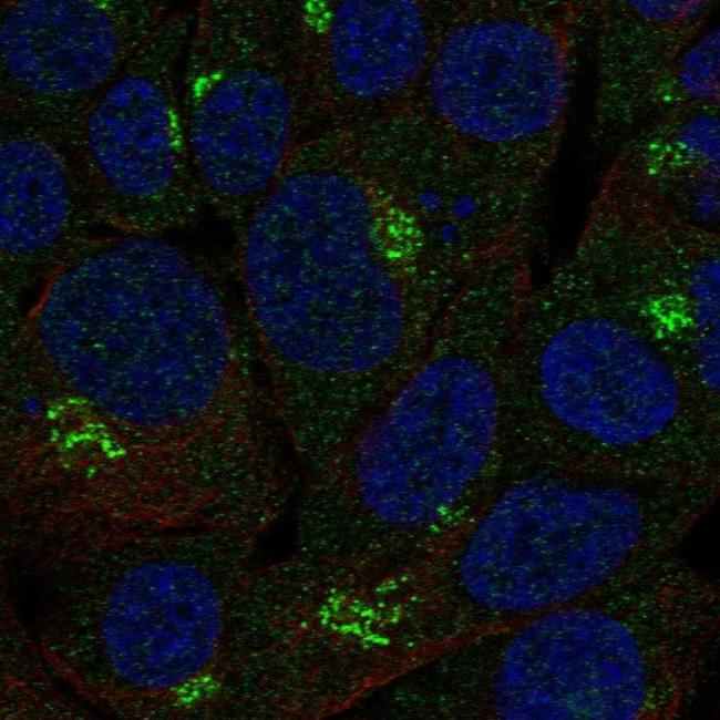 B3GALNT2 Antibody in Immunocytochemistry (ICC/IF)