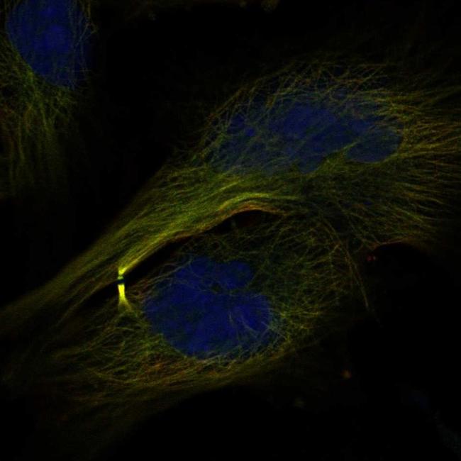 CENPE Antibody in Immunocytochemistry (ICC/IF)