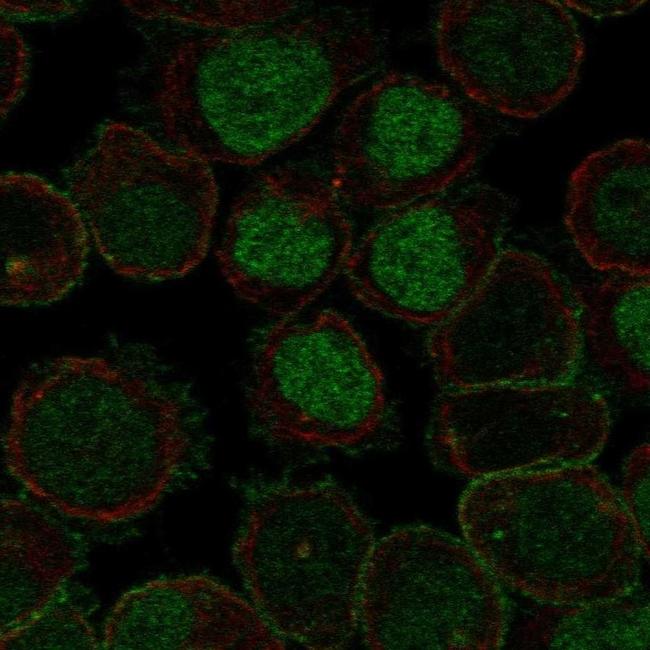 ROBO2 Antibody in Immunocytochemistry (ICC/IF)