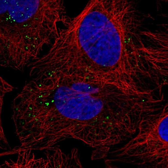 VPS25 Antibody in Immunocytochemistry (ICC/IF)