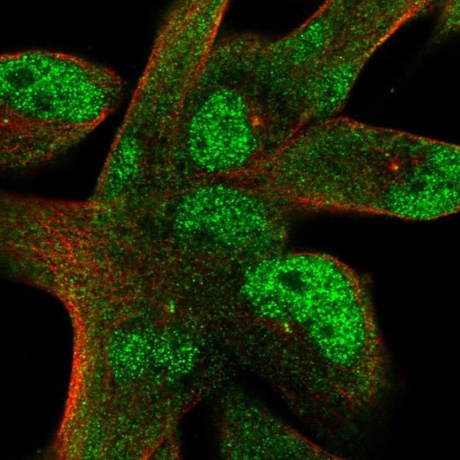 STIL Antibody in Immunocytochemistry (ICC/IF)