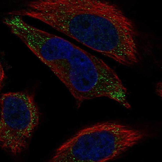 LHFPL5 Antibody in Immunocytochemistry (ICC/IF)