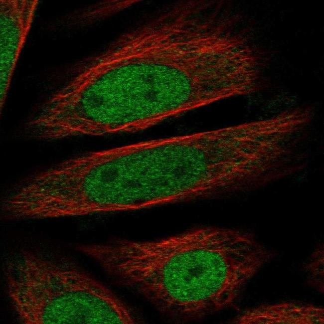 RNF20 Antibody in Immunocytochemistry (ICC/IF)