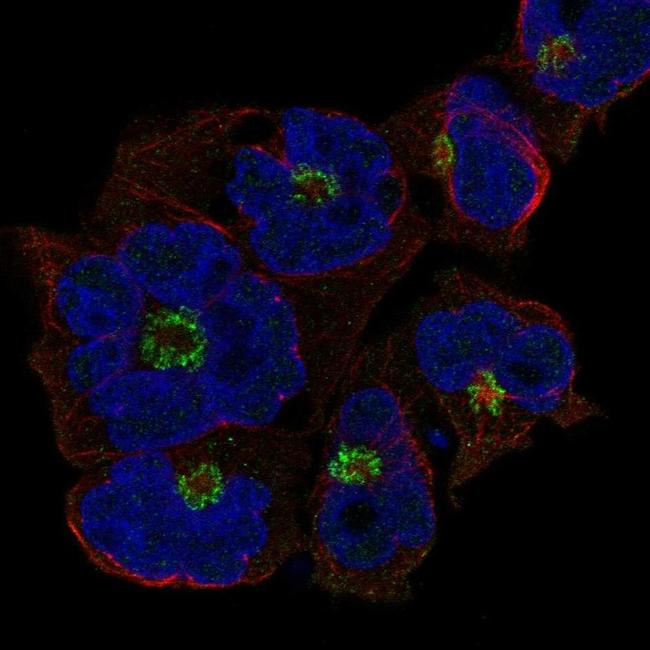 ST8SIA4 Antibody in Immunocytochemistry (ICC/IF)