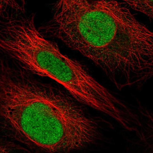 HOXB1 Antibody in Immunocytochemistry (ICC/IF)