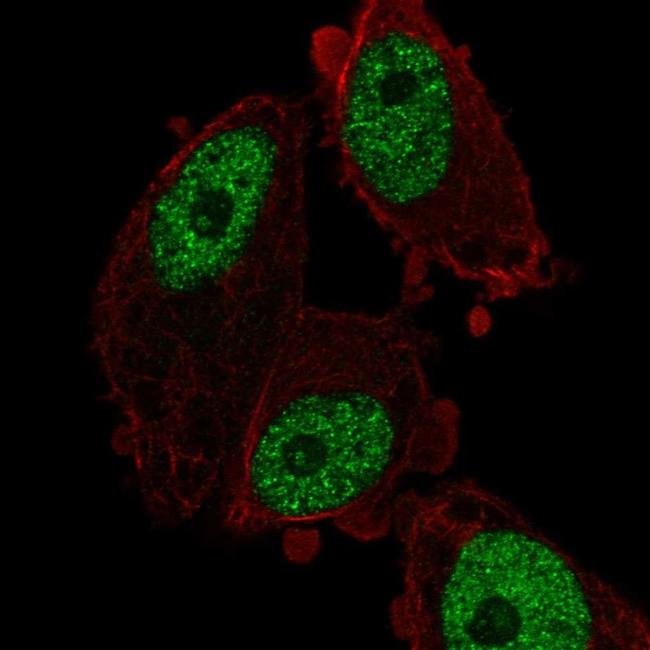 MED26 Antibody in Immunocytochemistry (ICC/IF)