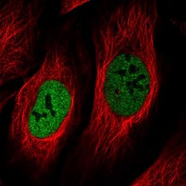 NEK5 Antibody in Immunocytochemistry (ICC/IF)