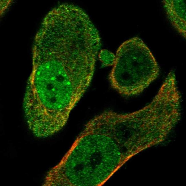 PARG Antibody in Immunocytochemistry (ICC/IF)