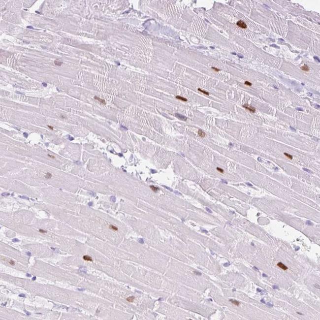 ADSSL1 Antibody in Immunohistochemistry (Paraffin) (IHC (P))