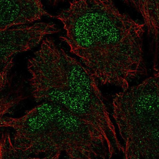 CHP2 Antibody in Immunocytochemistry (ICC/IF)