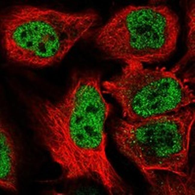 BAZ1B Antibody in Immunocytochemistry (ICC/IF)