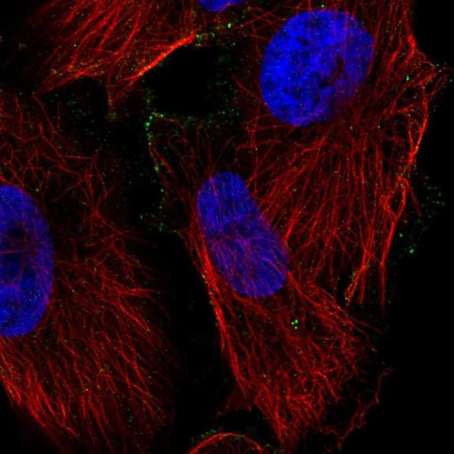 PPAP2C Antibody in Immunocytochemistry (ICC/IF)