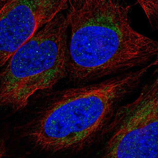 IRG1 Antibody in Immunocytochemistry (ICC/IF)