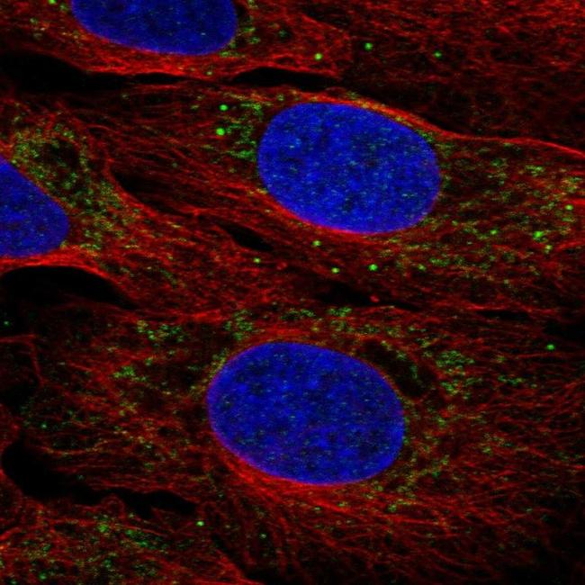 BBS2 Antibody in Immunocytochemistry (ICC/IF)