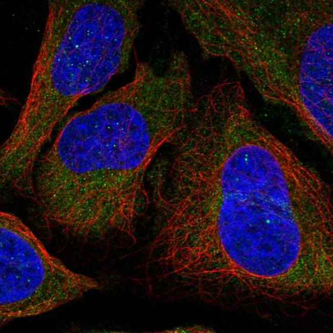 DLC1 Antibody in Immunocytochemistry (ICC/IF)