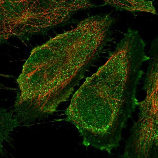 CD83 Antibody in Immunocytochemistry (ICC/IF)