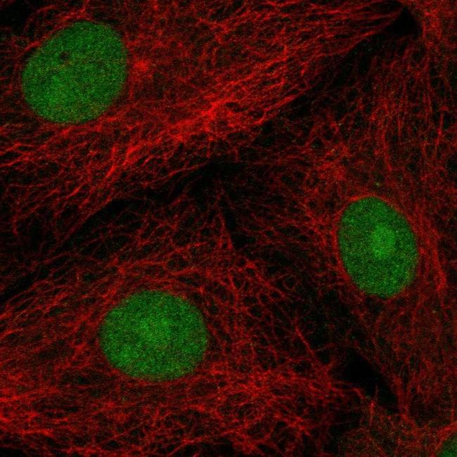 POP4 Antibody in Immunocytochemistry (ICC/IF)